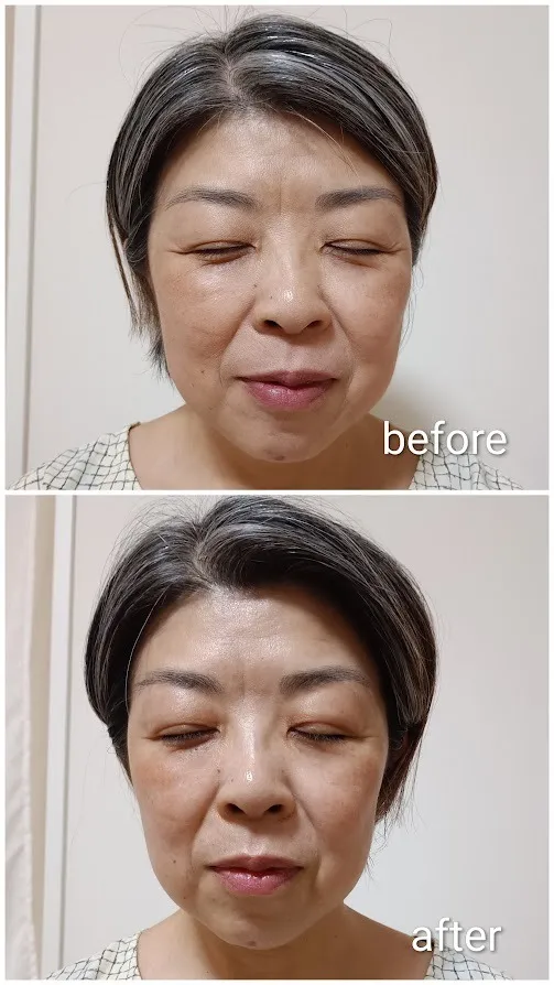 フェイシャルのご感想